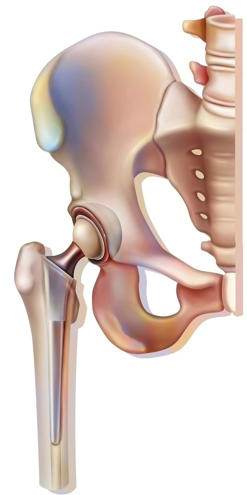 articulation à rotule similaire à l'articulation de la hanche humaine